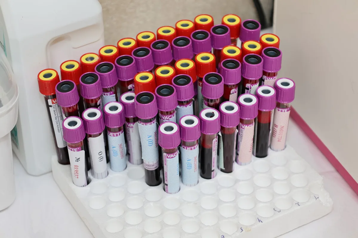 Rows of labelled blood sample tubes in a laboratory